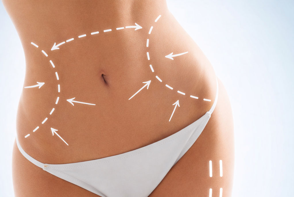 slider_02_bis Slider image