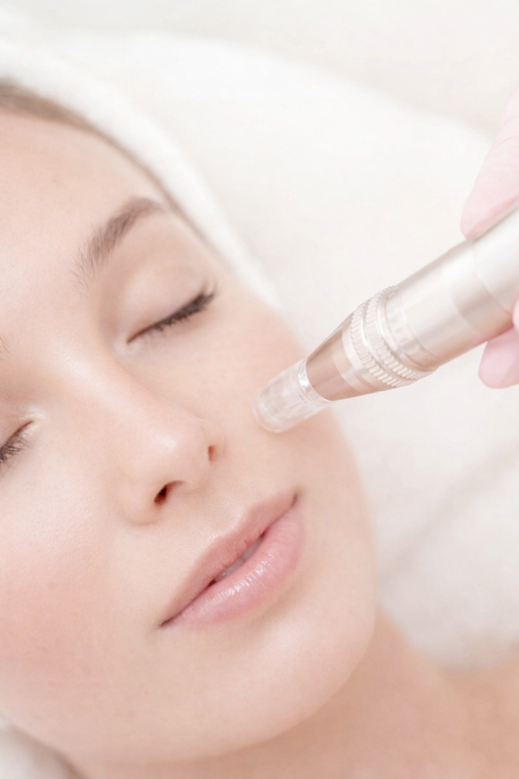 Microneedling visage
